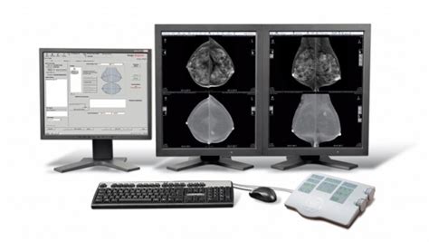 mammogram the villages fl